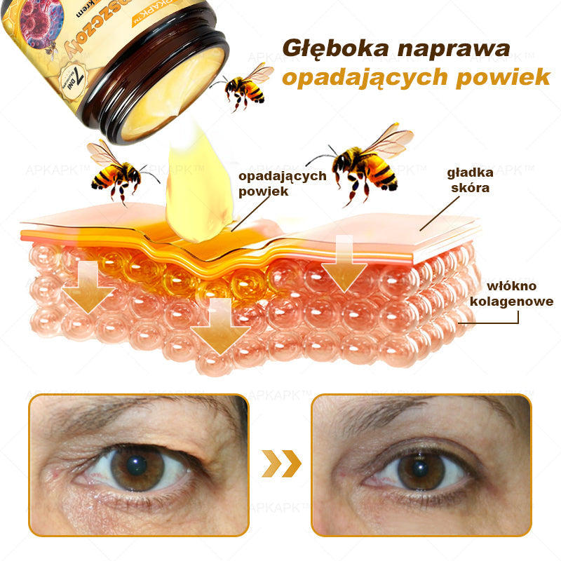 ΑPΚΑPK™Jad Pszczoły Kompleksowy Krem🧑⚕️🧑⚕️ 🥇pomaga w leczeniu problemów skórnych, takich jak: zmarszczki, blizny, plamy pigmentacyjne, rozstępy, trądzik, łuszczyca, egzema, zmiany skórne, podrażnienia, stany zapalne i inne problemy skórne🔥