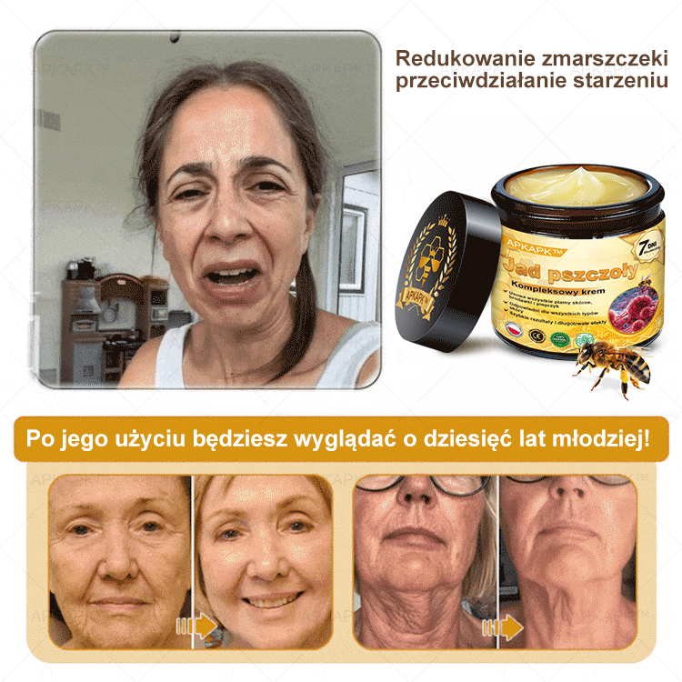ΑPΚΑPK™Jad Pszczoły Kompleksowy Krem🧑⚕️🧑⚕️ 🥇pomaga w leczeniu problemów skórnych, takich jak: zmarszczki, blizny, plamy pigmentacyjne, rozstępy, trądzik, łuszczyca, egzema, zmiany skórne, podrażnienia, stany zapalne i inne problemy skórne🔥