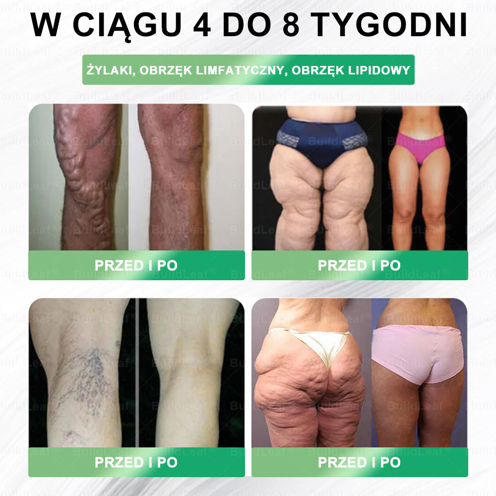 BuildLeaf®🎁 Zostało tylko 5 butelek! Oferujemy Ci dodatkowe 50% rabatu! Zadbaj o formę i zdrowie. Jeśli przegapisz okazję teraz, kolejna nadarzy się za rok.