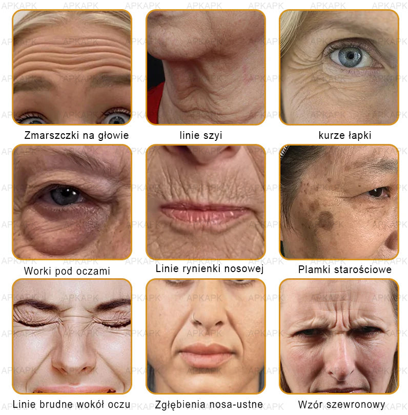 ΑPΚΑPK™Jad Pszczoły Kompleksowy Krem🧑⚕️🧑⚕️ 🥇pomaga w leczeniu problemów skórnych, takich jak: zmarszczki, blizny, plamy pigmentacyjne, rozstępy, trądzik, łuszczyca, egzema, zmiany skórne, podrażnienia, stany zapalne i inne problemy skórne🔥