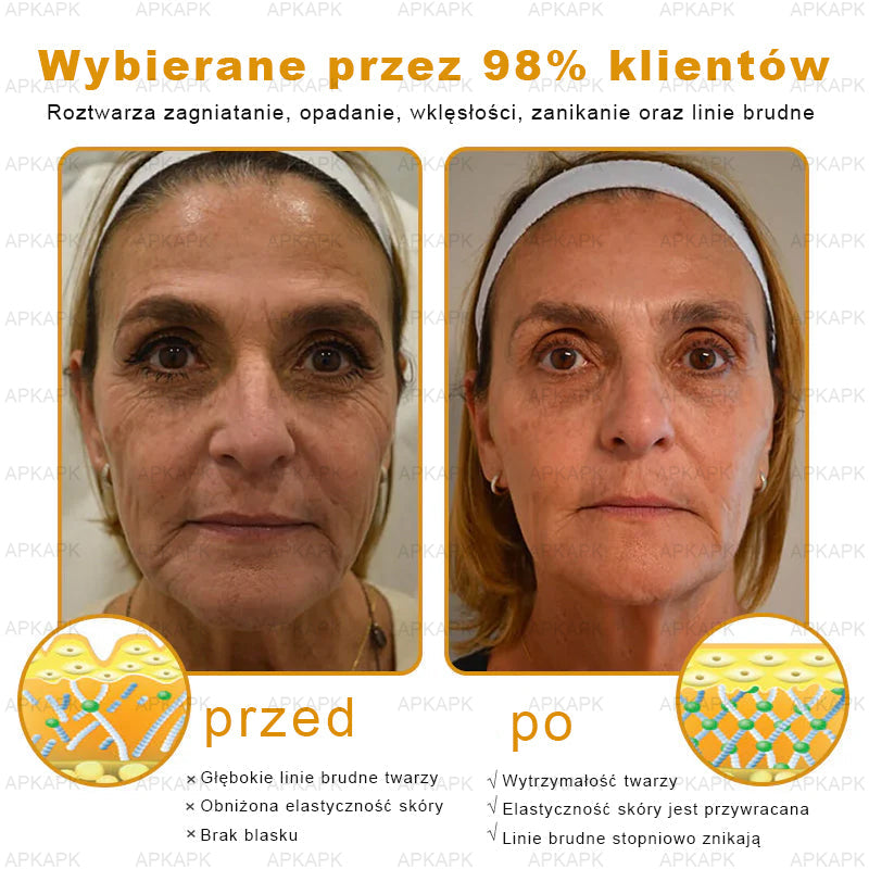 ΑPΚΑPK™Jad Pszczoły Kompleksowy Krem🧑⚕️🧑⚕️ 🥇pomaga w leczeniu problemów skórnych, takich jak: zmarszczki, blizny, plamy pigmentacyjne, rozstępy, trądzik, łuszczyca, egzema, zmiany skórne, podrażnienia, stany zapalne i inne problemy skórne🔥