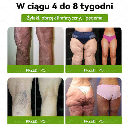 Wyprodukowano i wysłano z Polski 🌸BuildLeaf® Tyrzepatyd GLP-1 Krople odchudzające i wspomagające zdrowie🔥🔥 OSTATNI DZIEŃ – SKORZYSTAJ Z 80% ZNIŻKI!