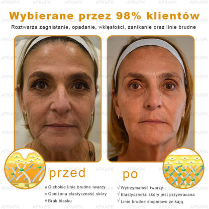 🎁 Ostatnia szansa! Zgarnij to szczęśliwe znalezisko z 70% ZNIŻKĄ!